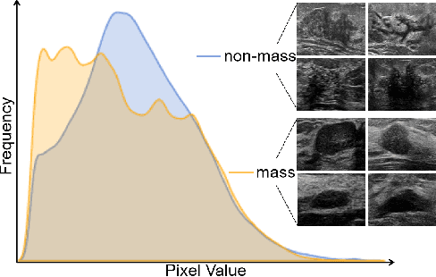 Figure 1 for Enhancing Non-mass Breast Ultrasound Cancer Classification With Knowledge Transfer