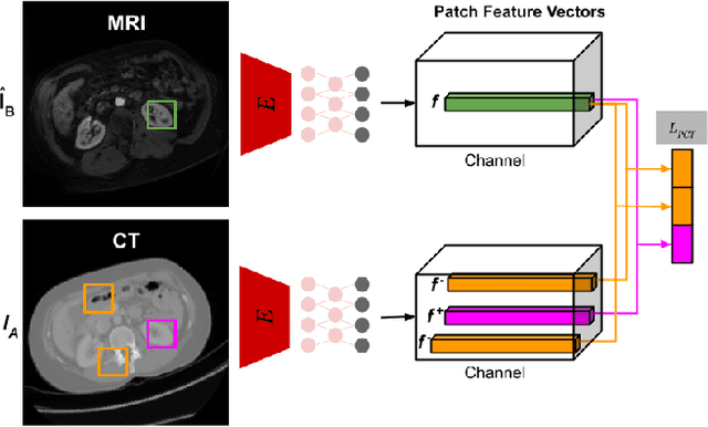 Figure 3 for Anatomy-Constrained Contrastive Learning for Synthetic Segmentation without Ground-truth