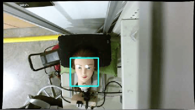 Figure 2 for Vision-based Control of a Soft Robot for Maskless Head and Neck Cancer Radiotherapy
