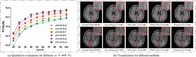 Figure 3 for Deep Geometric Distillation Network for Compressive Sensing MRI