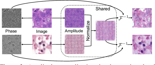 Figure 3 for HarmoFL: Harmonizing Local and Global Drifts in Federated Learning on Heterogeneous Medical Images