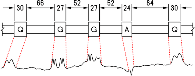 Figure 1 for Pattern Localization in Time Series through Signal-To-Model Alignment in Latent Space