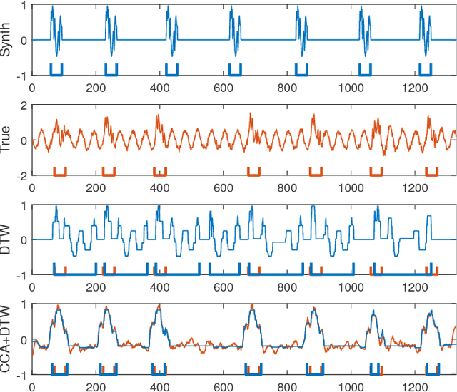 Figure 4 for Pattern Localization in Time Series through Signal-To-Model Alignment in Latent Space