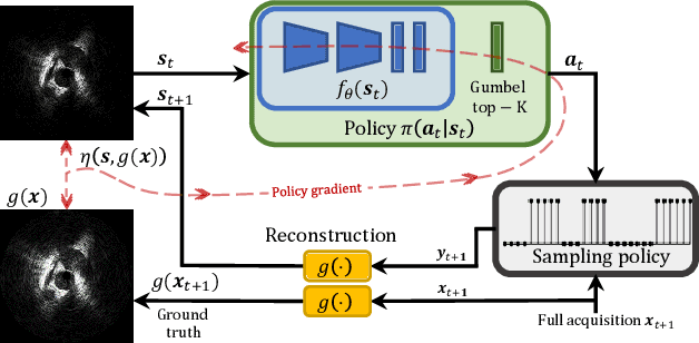 Figure 1 for Accelerated Intravascular Ultrasound Imaging using Deep Reinforcement Learning