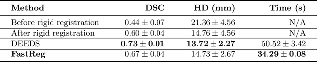 Figure 4 for FastReg: Fast Non-Rigid Registration via Accelerated Optimisation on the Manifold of Diffeomorphisms