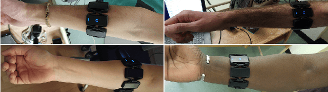 Figure 3 for Deep Learning for Electromyographic Hand Gesture Signal Classification Using Transfer Learning