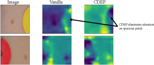 Figure 4 for Interpretations are useful: penalizing explanations to align neural networks with prior knowledge