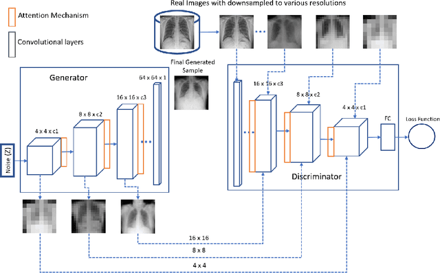 Figure 2 for A Self-attention Guided Multi-scale Gradient GAN for Diversified X-ray Image Synthesis