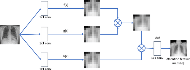 Figure 3 for A Self-attention Guided Multi-scale Gradient GAN for Diversified X-ray Image Synthesis