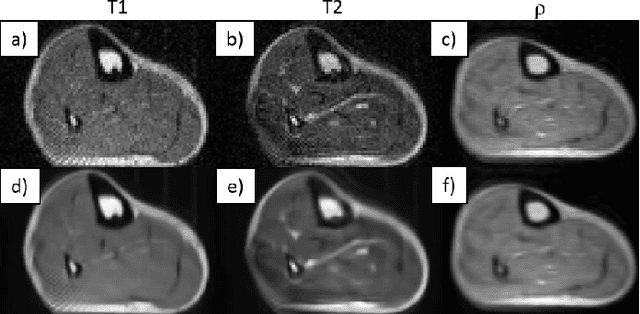 Figure 2 for Benchmarking the performance of a low-cost Magnetic Resonance Control System at multiple sites in the open MaRCoS community