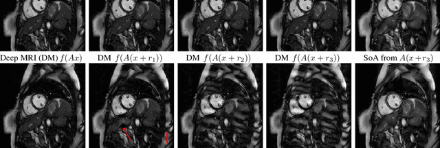 Figure 1 for On instabilities of deep learning in image reconstruction - Does AI come at a cost?