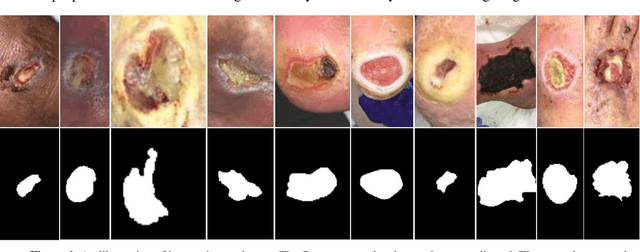 Figure 1 for Fully Automatic Wound Segmentation with Deep Convolutional Neural Networks