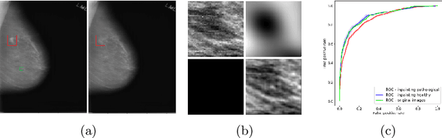 Figure 1 for Domain aware medical image classifier interpretation by counterfactual impact analysis