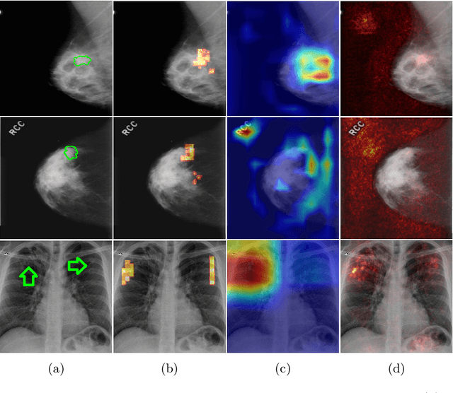 Figure 4 for Domain aware medical image classifier interpretation by counterfactual impact analysis