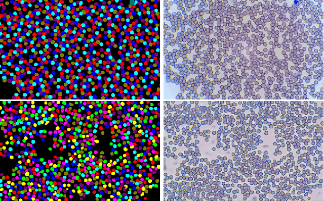 Figure 1 for Red blood cell image generation for data augmentation using Conditional Generative Adversarial Networks