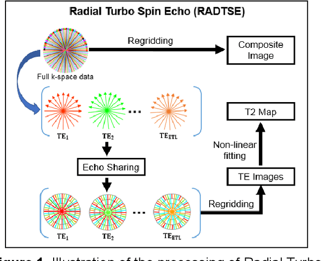 Figure 1 for A Comparison of Deep Learning Convolution Neural Networks for Liver Segmentation in Radial Turbo Spin Echo Images