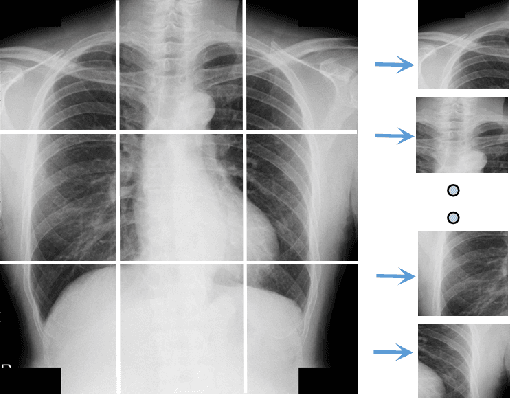 Figure 3 for Lumbar Bone Mineral Density Estimation from Chest X-ray Images: Anatomy-aware Attentive Multi-ROI Modeling