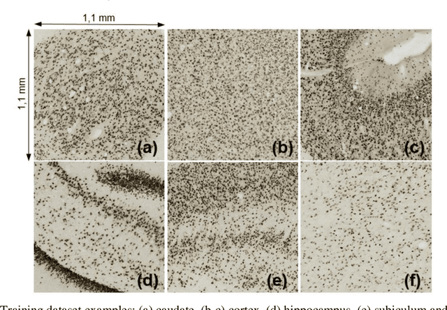 Figure 1 for Evaluation of Deep Learning Topcoders Method for Neuron Individualization in Histological Macaque Brain Section