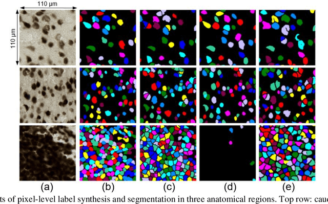 Figure 3 for Evaluation of Deep Learning Topcoders Method for Neuron Individualization in Histological Macaque Brain Section