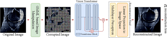 Figure 1 for SB-SSL: Slice-Based Self-Supervised Transformers for Knee Abnormality Classification from MRI