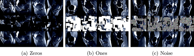Figure 4 for SB-SSL: Slice-Based Self-Supervised Transformers for Knee Abnormality Classification from MRI