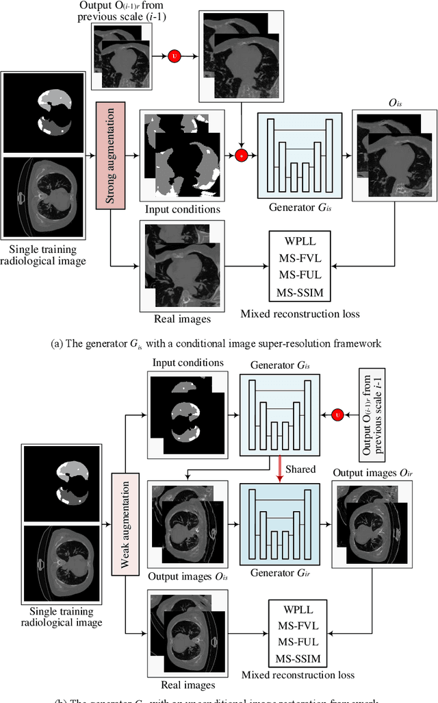 Figure 4 for Learning Diagnosis of COVID-19 from a Single Radiological Image