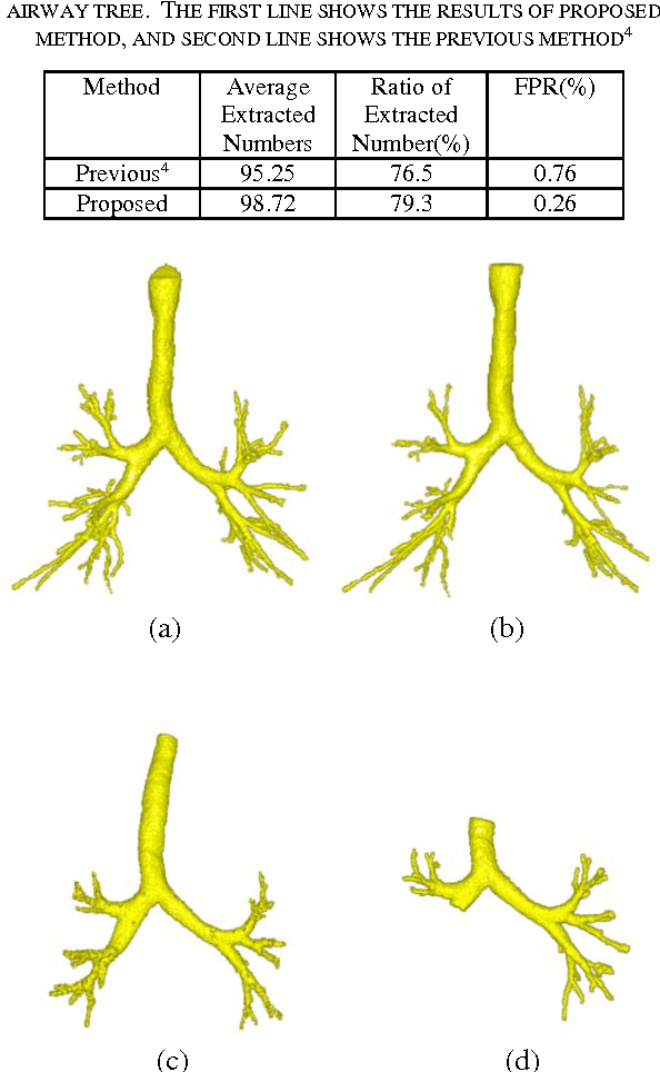 Figure 4 for Airway segmentation from 3D chest CT volumes based on volume of interest using gradient vector flow