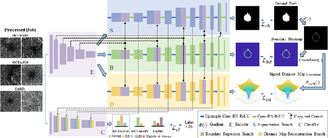 Figure 1 for BSDA-Net: A Boundary Shape and Distance Aware Joint Learning Framework for Segmenting and Classifying OCTA Images