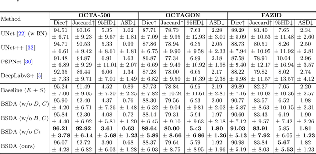 Figure 4 for BSDA-Net: A Boundary Shape and Distance Aware Joint Learning Framework for Segmenting and Classifying OCTA Images