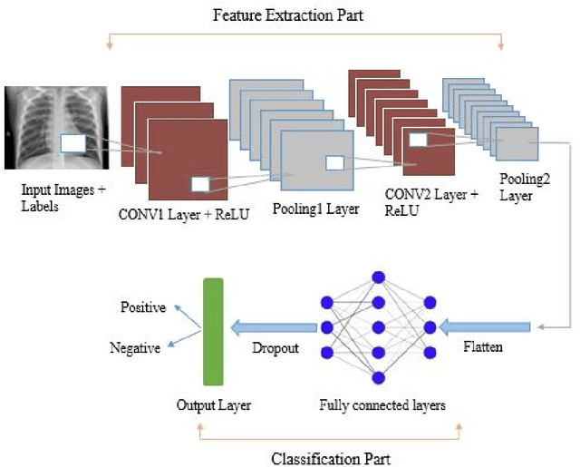 Figure 2 for Hybrid quantum convolutional neural networks model for COVID-19 prediction using chest X-Ray images