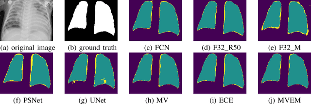 Figure 4 for Calibrated Bagging Deep Learning for Image Semantic Segmentation: A Case Study on COVID-19 Chest X-ray Image