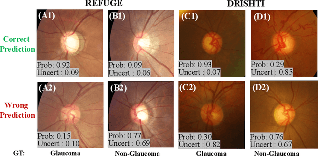 Figure 4 for Difficulty-aware Glaucoma Classification with Multi-Rater Consensus Modeling