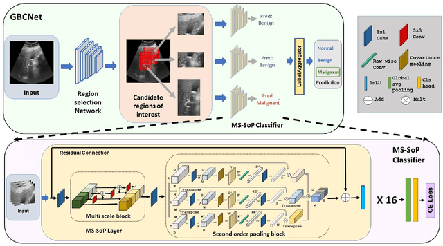 Figure 3 for Surpassing the Human Accuracy: Detecting Gallbladder Cancer from USG Images with Curriculum Learning