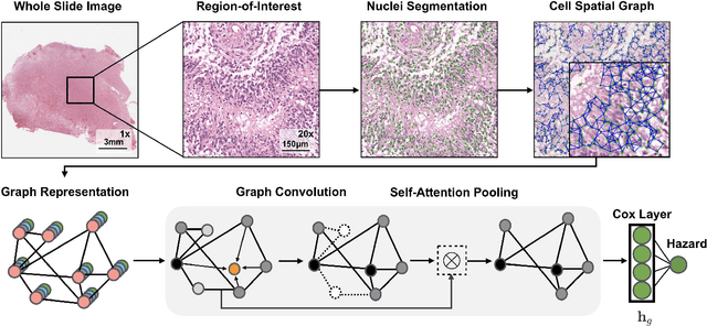 Figure 2 for Pathomic Fusion: An Integrated Framework for Fusing Histopathology and Genomic Features for Cancer Diagnosis and Prognosis