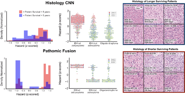 Figure 3 for Pathomic Fusion: An Integrated Framework for Fusing Histopathology and Genomic Features for Cancer Diagnosis and Prognosis