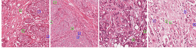 Figure 1 for AMDet: A Tool for Mitotic Cell Detection in Histopathology Slides