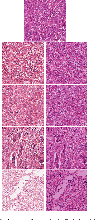 Figure 2 for AMDet: A Tool for Mitotic Cell Detection in Histopathology Slides