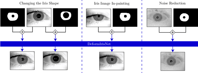 Figure 1 for DeformIrisNet: An Identity-Preserving Model of Iris Texture Deformation