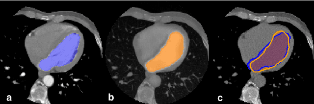 Figure 2 for Synthetic contrast enhancement in cardiac CT with Deep Learning