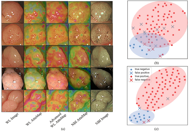 Figure 4 for Toward Clinically Assisted Colorectal Polyp Recognition via Structured Cross-modal Representation Consistency