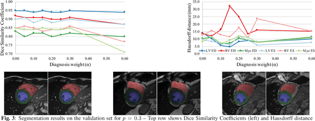 Figure 4 for End-to-End Diagnosis and Segmentation Learning from Cardiac Magnetic Resonance Imaging