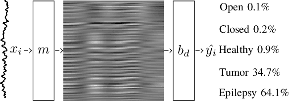 Figure 1 for Signal2Image Modules in Deep Neural Networks for EEG Classification