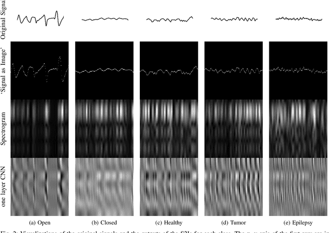 Figure 2 for Signal2Image Modules in Deep Neural Networks for EEG Classification