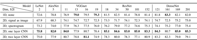 Figure 3 for Signal2Image Modules in Deep Neural Networks for EEG Classification