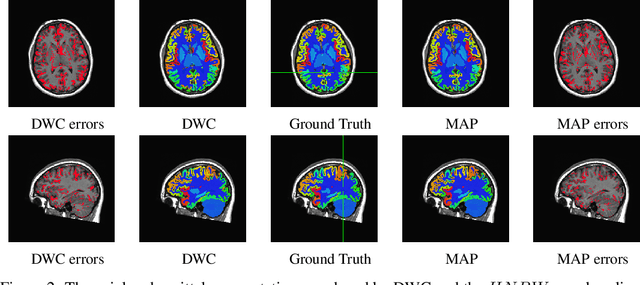 Figure 3 for Distributed Weight Consolidation: A Brain Segmentation Case Study