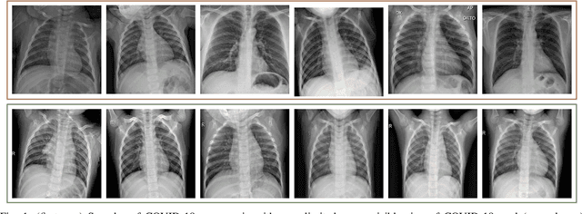 Figure 1 for A Comparative Study on Early Detection of COVID-19 from Chest X-Ray Images