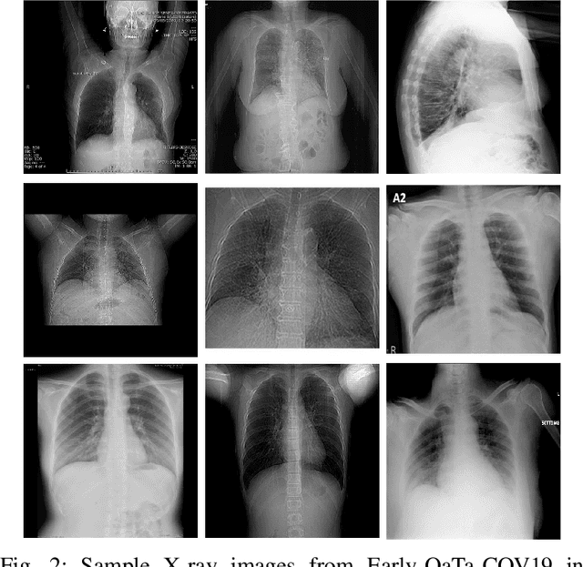 Figure 2 for A Comparative Study on Early Detection of COVID-19 from Chest X-Ray Images