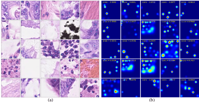 Figure 2 for Nuclei Detection Using Mixture Density Networks