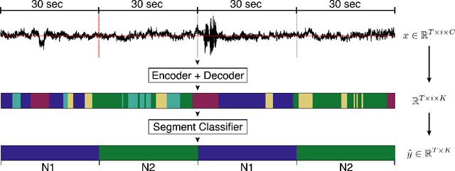 Figure 1 for U-Time: A Fully Convolutional Network for Time Series Segmentation Applied to Sleep Staging