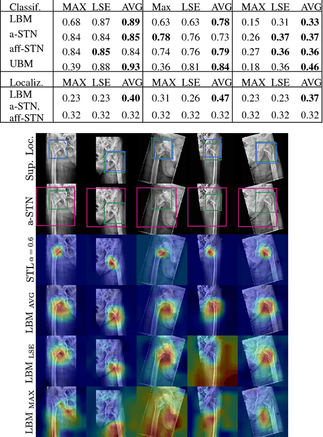 Figure 4 for Weakly-Supervised Localization and Classification of Proximal Femur Fractures